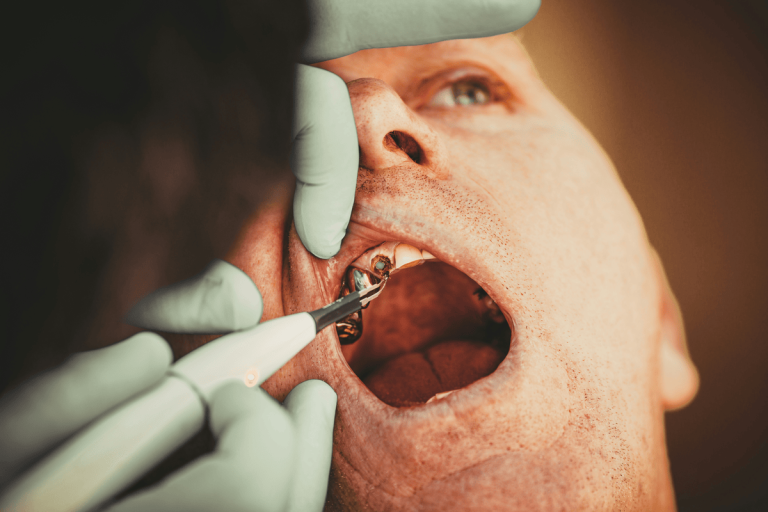 Nerovet AI Dentistry 2025: Expert review, features, pricing, and risks